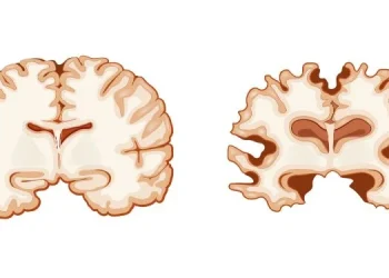Alzheimer, scoperta una “molecola smart” che protegge i neuroni: i risultati dello studio italiano